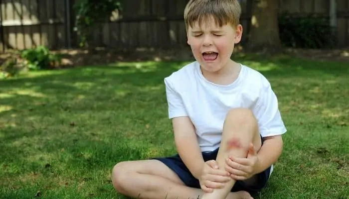 child crying scraped knee