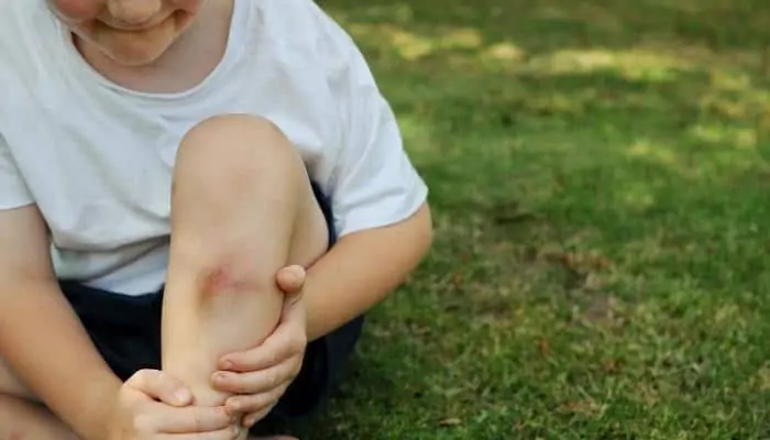 child with knee that's scraped