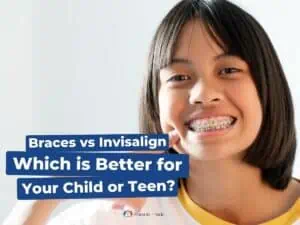 Braces vs Invisalign: Which is Better for Your Child or Teen?